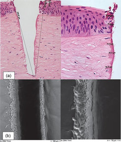 Incision into the corneal stroma with the PIRL laser. Histological view with hematoxylin and eosin staining (image a), and environmental scanning electron microscope (ESEM) view (image b) – magnification 200x and 400x. All methods show precise cutting edges of the PIRL incision. Only the first layer of cells adjacent to the incision is affected by thermal effects.