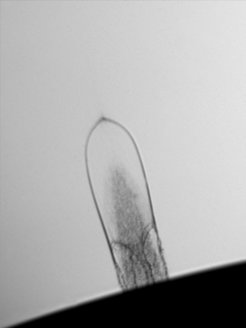 Das Bild zeigt eine lasererzeugte Oberflächenblase aus flüssigem Glycerin, die zweieinhalb Mikrosekunden lang in Bewegung war und sich um etwa 600 Mikrometer ausgedehnt hat. Kayanattil et al. beobachteten während ihres dynamischen Prozesses ein unerwartetes elastisches Verhalten.